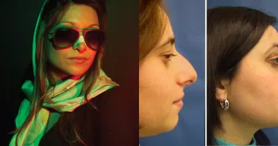 Phụ nữ Iran sửa mũi nhiều nhất thế giới (Ảnh: Internet)