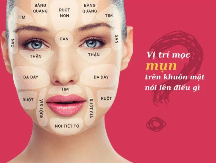 Vị trí mọc mụn nói lên điều gì? (Ảnh: Internet). Vị trí mọc mụn nói lên điều gì? (Ảnh: Internet).