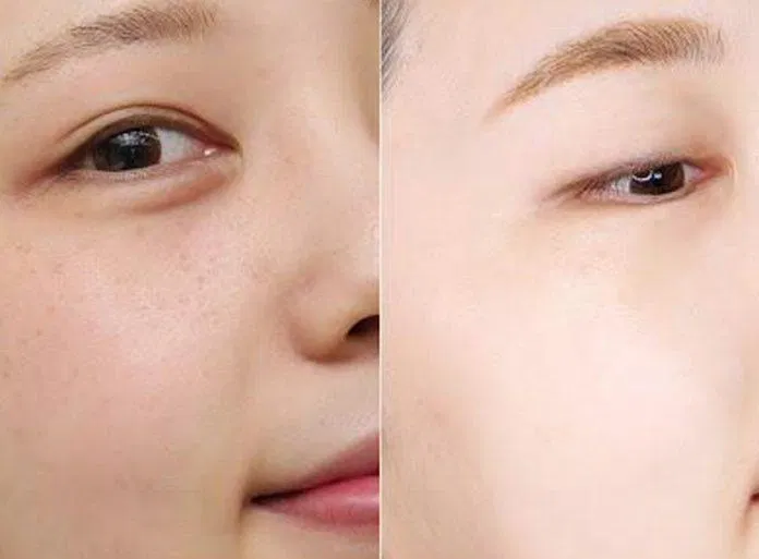 Tinh chất dưỡng sáng da AHC Niacin Biome Mela Scissors Max Essence có công dụng chính là làm sáng da nên sẽ phù hợp với những làn da như