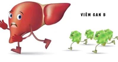 Nguyên nhân gây ra bệnh viêm gan B là virus HBV (Nguồn: Internet) Nguyên nhân gây ra bệnh viêm gan B là virus HBV (Nguồn: Internet)