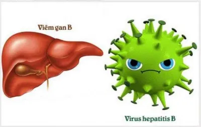 Điều trị bệnh viêm gan B (Nguồn: Internet) Điều trị bệnh viêm gan B (Nguồn: Internet)