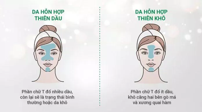 Da hỗn hợp