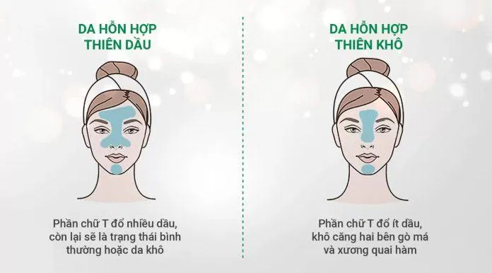 Da hỗn hợp
