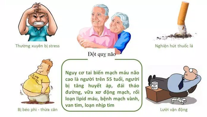 Đột quỵ là gì (Nguồn: Internet) Đột quỵ là gì (Nguồn: Internet)