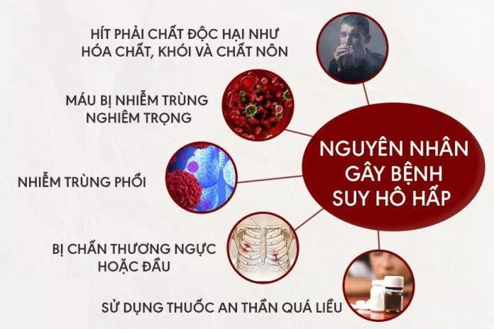 Nguyên nhân gây suy hô hấp (Nguồn: Internet) Nguyên nhân gây suy hô hấp (Nguồn: Internet)