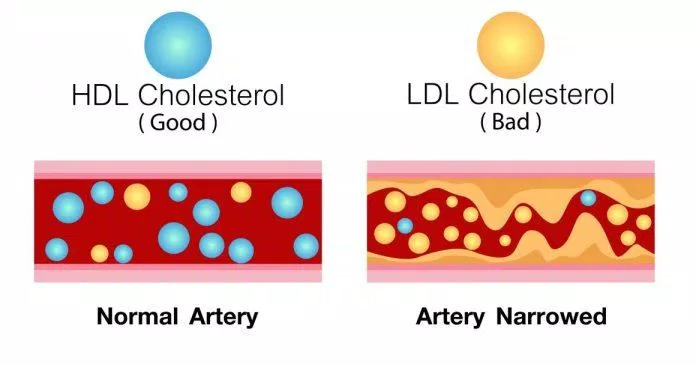 Sô cô la làm tăng HDL và bảo vệ LDL khỏi quá trình oxy hóa (Ảnh: Internet)