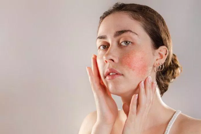 Peptide giúp chốngvig viêm da (Ảnh: Internet)