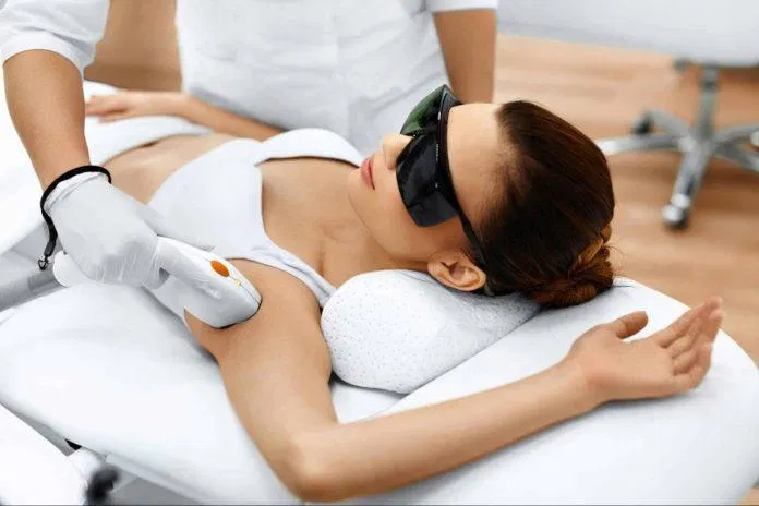 Tẩy lông bằng tia laser sẽ giúp vùng da nách của bạn giảm các tình trạng viêm nhiễm (Ảnh: Internet)
