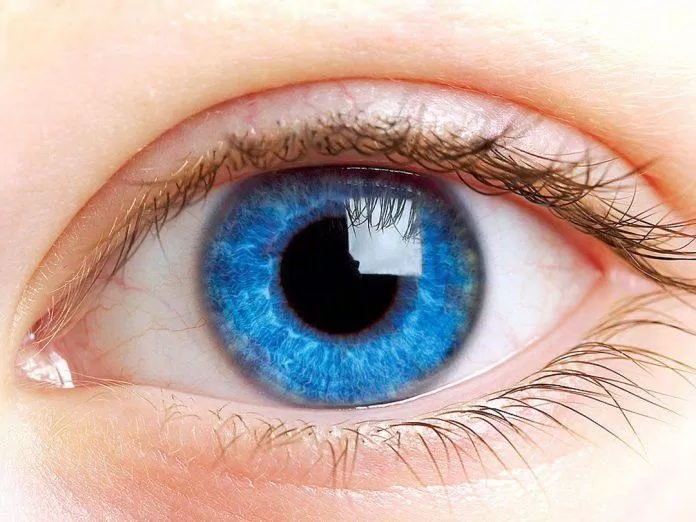 Mống mắt xuất hiện màu trắng (Nguồn: Internet)