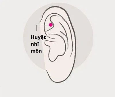 Bấm huyệt chữa mất ngủ: Huyệt nhĩ môn (Ảnh: Internet)