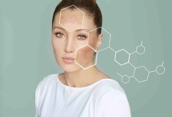 Tại sao da lại xuất hiện đồi mồi - Mách bạn cách trị đồi mồi cực kì hiệu quả đôi môi Một số dấu hiệu của đồi mồi Nguyên nhân gây ra tình trạng đồi mồi Trị dứt điểm đồi mồi trị đồi mồi