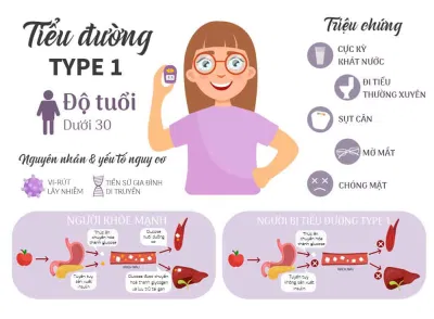 Mờ mắt là dấu hiệu của bệnh tiểu đường (Nguồn: Internet) Mờ mắt là dấu hiệu của bệnh tiểu đường (Nguồn: Internet)