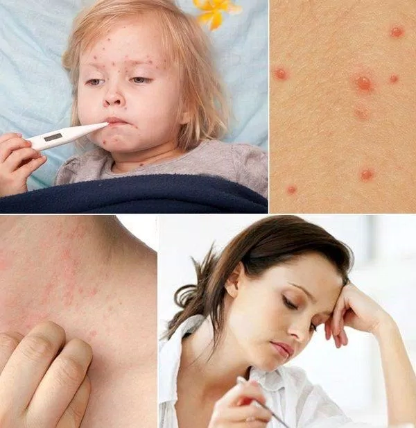 Hạn chế tiếp xúc với nước (Nguồn: Internet) Hạn chế tiếp xúc với nước (Nguồn: Internet)