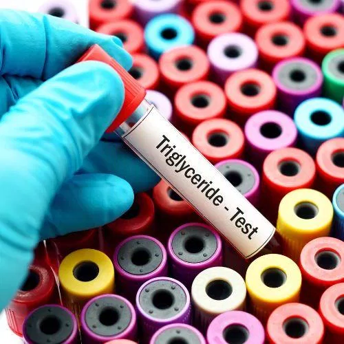 Xét nghiệm Triglycerid toàn phần: Chỉ số mỡ máu Triglycerid toàn phần ở mức bình thường nhỏ hơn 2,3 mmol/l (Nguồn: Internet) Xét nghiệm Triglycerid toàn phần: Chỉ số mỡ máu Triglycerid toàn phần ở mức bình thường nhỏ hơn 2,3 mmol/l (Nguồn: Internet)