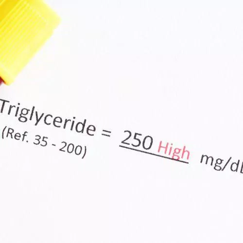 Triglyceride tăng cao sẽ ảnh hưởng đến quá trình lưu thông máu và tác động xấu đến sức khỏe (Nguồn: Internet) Triglyceride tăng cao sẽ ảnh hưởng đến quá trình lưu thông máu và tác động xấu đến sức khỏe (Nguồn: Internet)