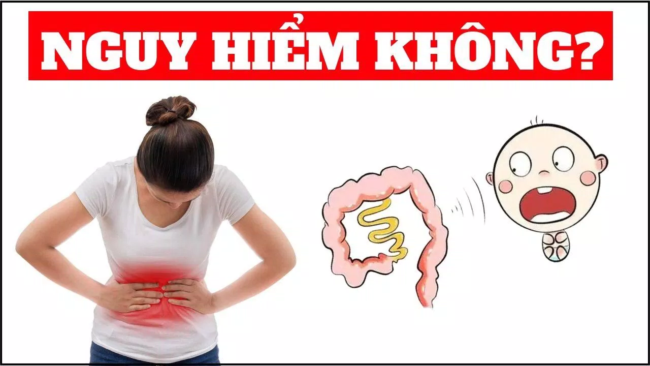 Nguyên nhân gây ra hội chứng này( Nguồn: Internet) Nguyên nhân gây ra hội chứng này( Nguồn: Internet)