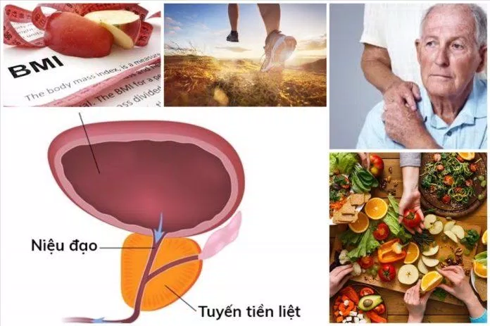 Dấu hiệu nhận biết ung thư tiền liệt tuyến (Nguồn: Internet) Dấu hiệu nhận biết ung thư tiền liệt tuyến (Nguồn: Internet)