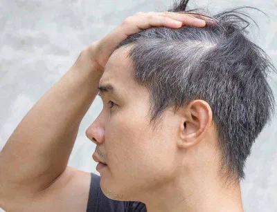Tóc bạc không là điều đáng lo ngại (Nguồn: Internet).