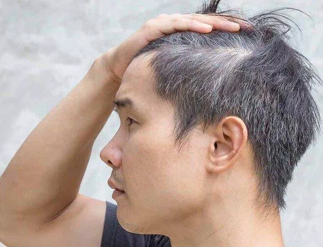 Tóc bạc không là điều đáng lo ngại (Nguồn: Internet).