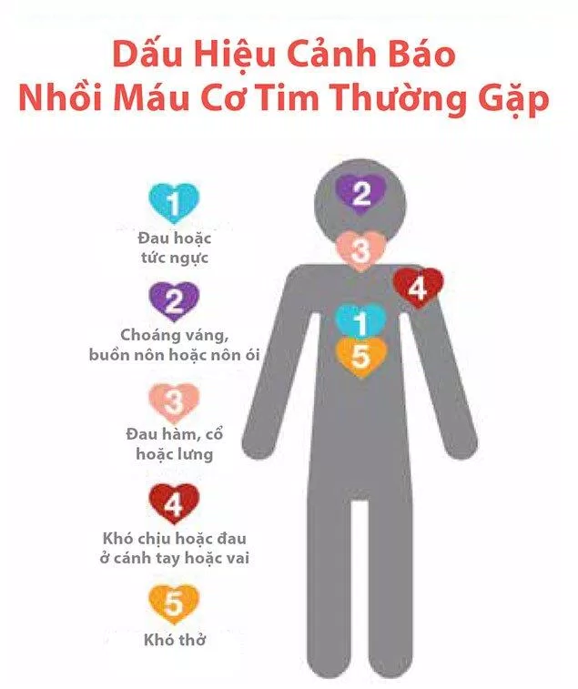 Dấu hiệu nhận biết nhồi máu cơ tim (Nguồn: Internet) Dấu hiệu nhận biết nhồi máu cơ tim (Nguồn: Internet)