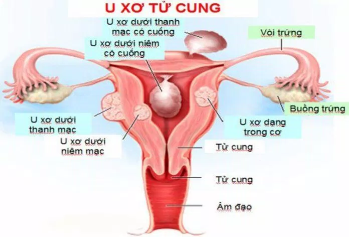 Tình trạng kinh nguyệt không ổn định( Nguồn: Internet) Tình trạng kinh nguyệt không ổn định( Nguồn: Internet)