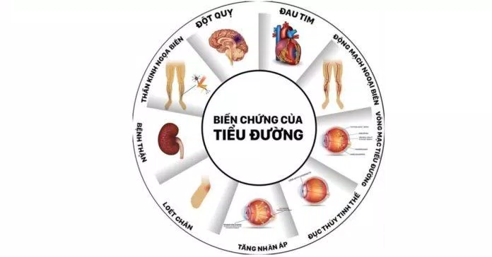 Biến chứng của đái tháo đường type 2 (Nguồn: Internet)