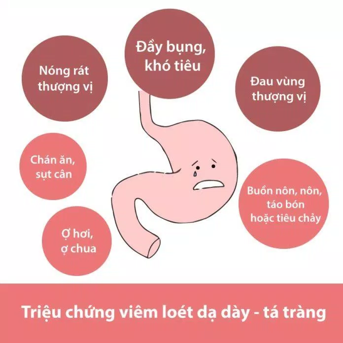 Triệu chứng viêm loét dạ dày - tá tràng (Nguồn: Internet) Triệu chứng viêm loét dạ dày - tá tràng (Nguồn: Internet)