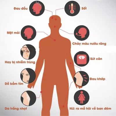 Chảy máu không rõ nguyên nhân( Nguồn: Internet) Chảy máu không rõ nguyên nhân( Nguồn: Internet)