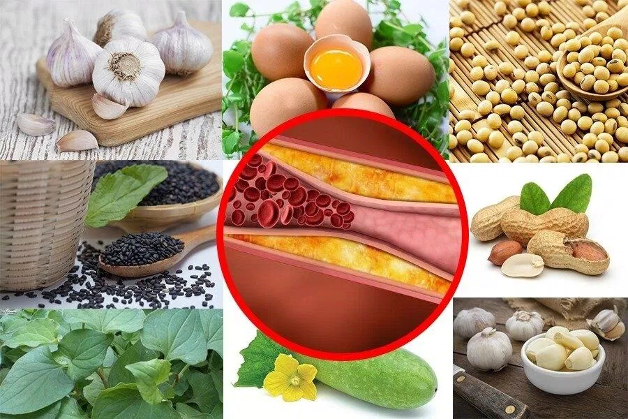 Người mắc mệnh mỡ máu không nên ăn gì? (Nguồn: Internet) Người mắc mệnh mỡ máu không nên ăn gì? (Nguồn: Internet)