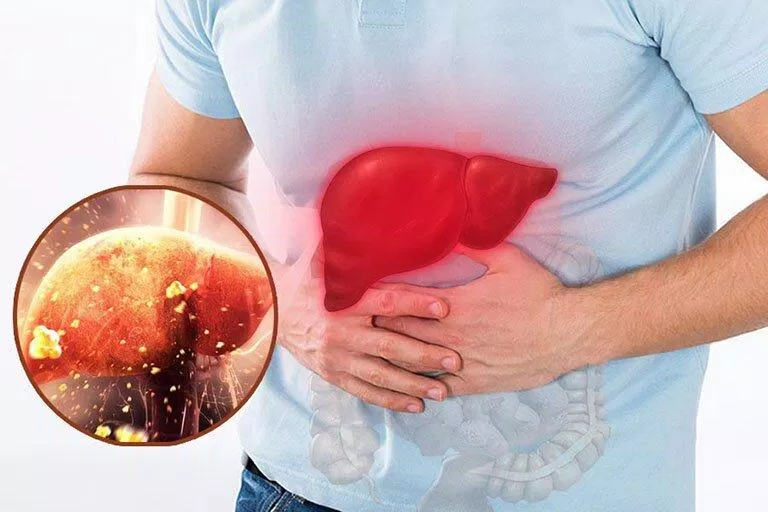 Cách phòng tình trạng men gan tăng. (Nguồn: Internet) Cách phòng tình trạng men gan tăng. (Nguồn: Internet)