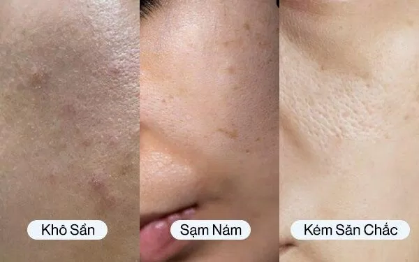 Các dấu hiệu lão hóa dần hình thành trên da.