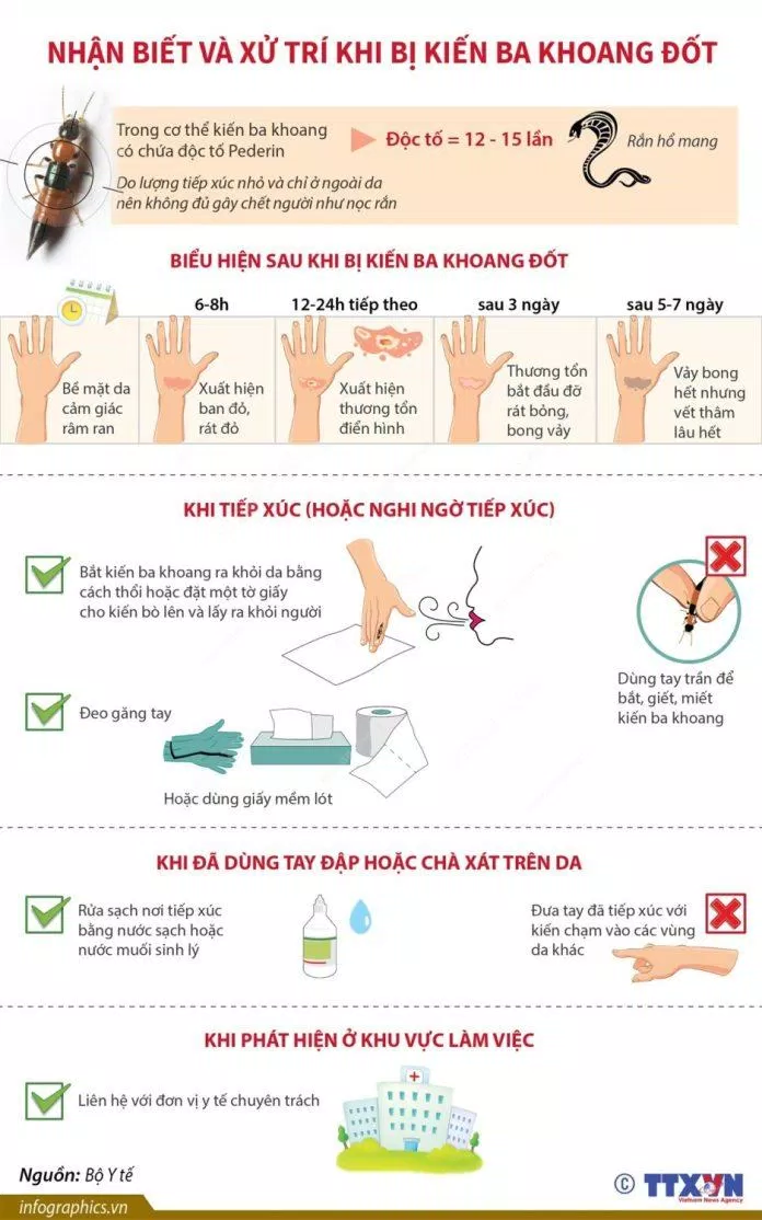 Nhận biết và xử trí khi bị kiến ba khoang đốt (Ảnh: Internet) Nhận biết và xử trí khi bị kiến ba khoang đốt (Ảnh: Internet)