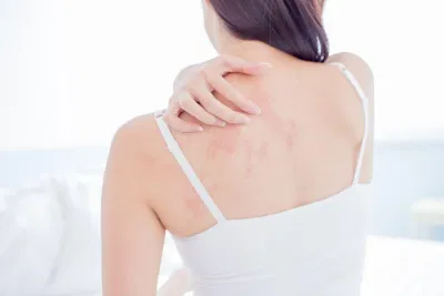 Nguyên nhân gây ra mụn lưng