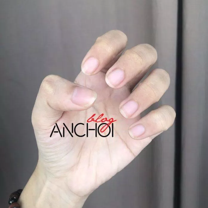 Móng tay của mình trong 10 ngày sử dụng để dài và khỏe hơn (Nguồn: BlogAnChoi) Móng tay của mình trong 10 ngày sử dụng để dài và khỏe hơn (Nguồn: BlogAnChoi)