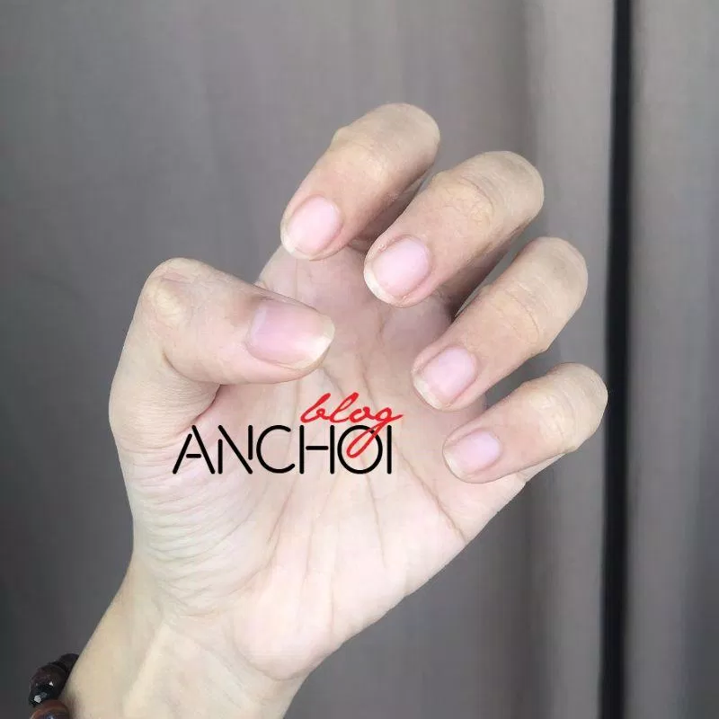 Móng tay của mình trong 10 ngày sử dụng để dài và khỏe hơn (Nguồn: BlogAnChoi) Móng tay của mình trong 10 ngày sử dụng để dài và khỏe hơn (Nguồn: BlogAnChoi)