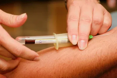 Kiểm tra cholesterol giúp bạn ngăn ngừa bệnh. (Nguồn: Internet) Kiểm tra cholesterol giúp bạn ngăn ngừa bệnh. (Nguồn: Internet)