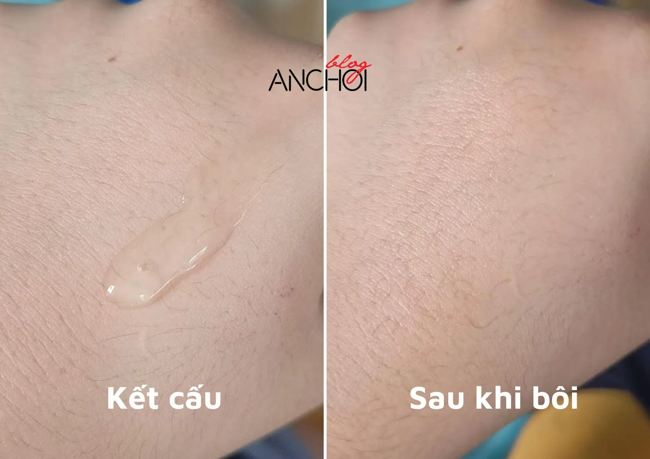 (Ảnh: BlogAnChoi).