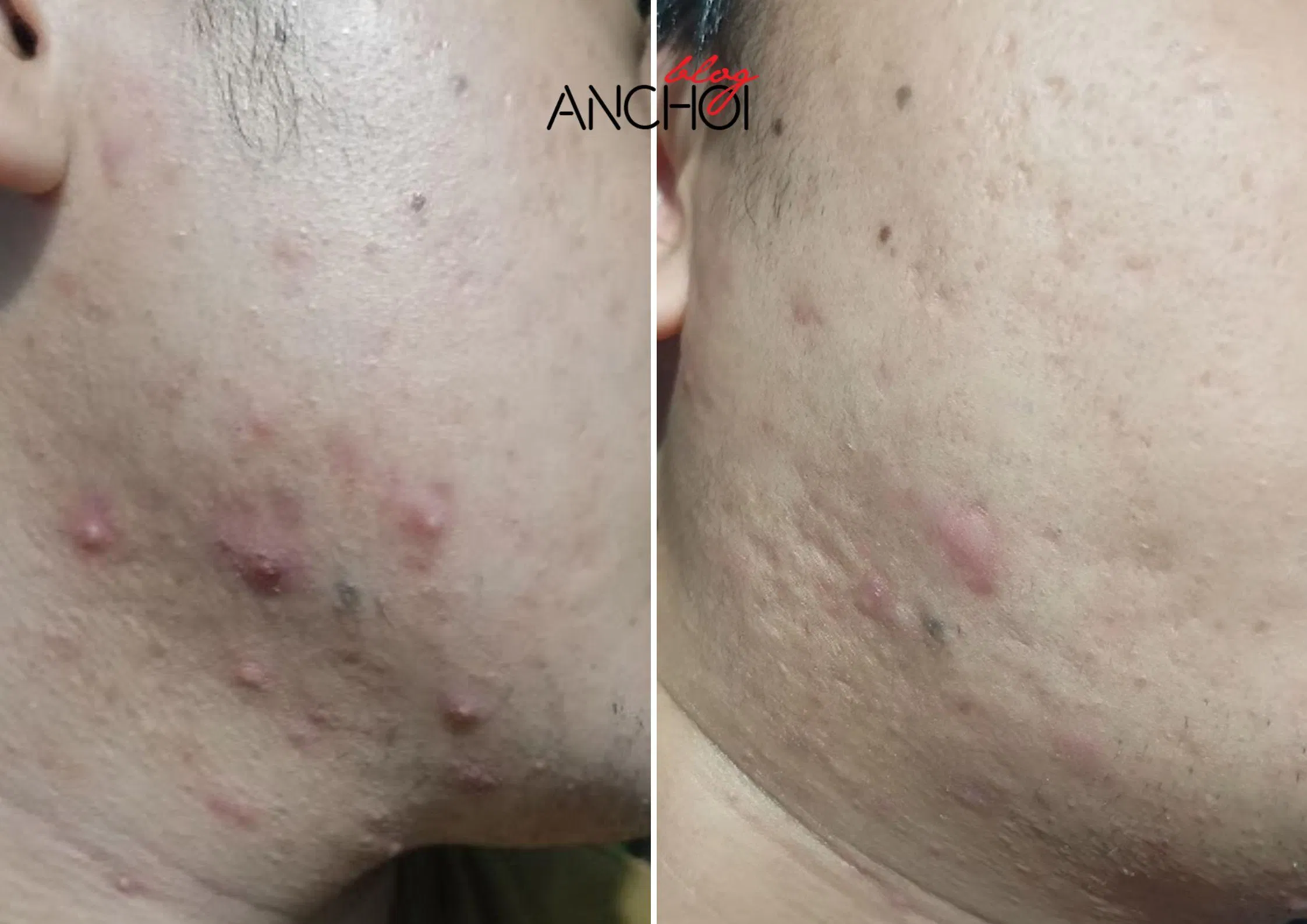 (Ảnh: BlogAnChoi).