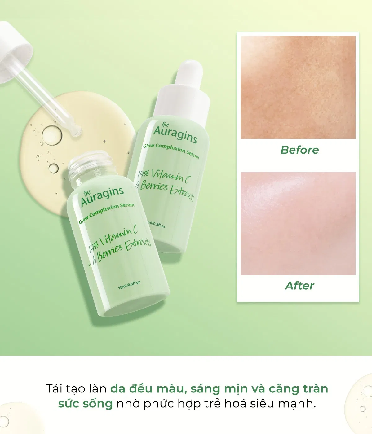 Hiệu quả sáng da ngừa thâm mà vẫn an toàn cho mọi loại da(Nguồn: Internet) Hiệu quả sáng da ngừa thâm mà vẫn an toàn cho mọi loại da(Nguồn: Internet)