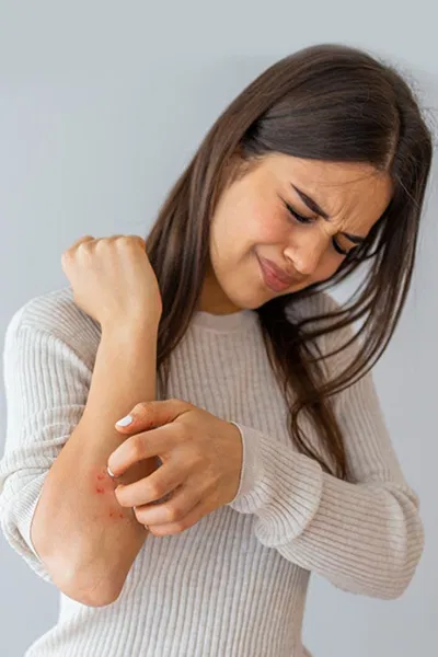 Khi quần áo cọ xát vào da, nó có thể gây kích ứng đau đớn và đổ mồ hôi có thể làm cho vết nứt trở nên tồi tệ hơn.(Nguồn: Internet)
