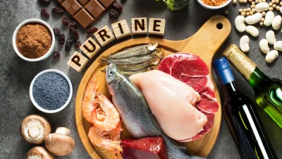 Các thực phẩm chứa nhiều purin có thể làm tăng axit uric (Ảnh: Internet) Các thực phẩm chứa nhiều purin có thể làm tăng axit uric (Ảnh: Internet)