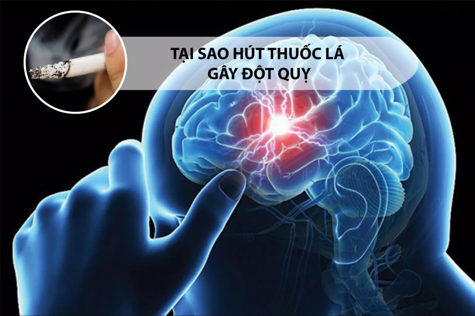 Tại sao hút thuốc lá gây đột quỵ? (Nguồn: Internet)