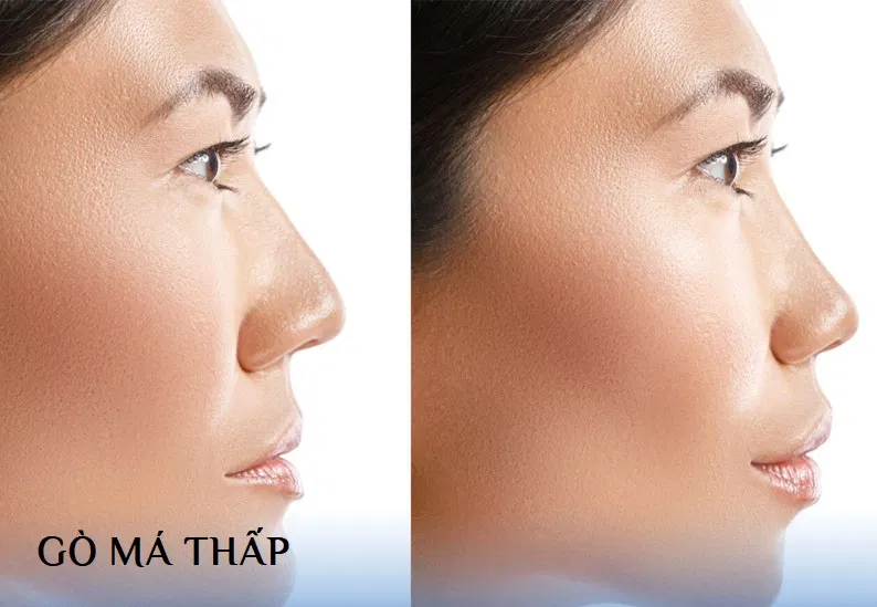 Xem tướng gò má thấp