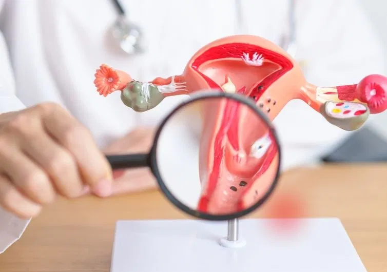 Sự mất cân bằng hormone estrogen và progesterone là nguyên nhân phổ biến gây rối loạn kinh nguyệt.