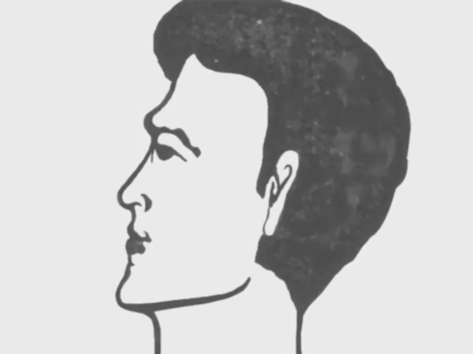 Tướng trán đàn ông lõm