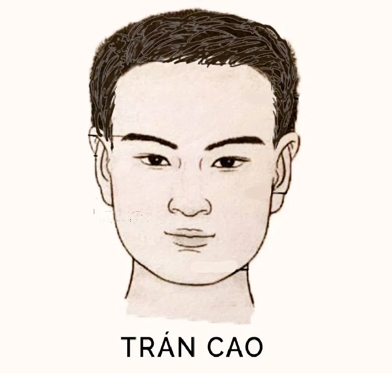 Tướng trán đàn ông cao (Ảnh: Internet)