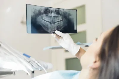 Ngoài kiểm tra miệng, cổ và đầu, bác sĩ có thể yêu cầu chụp CT để giúp hình dung mức độ nhiễm trùng của bạn