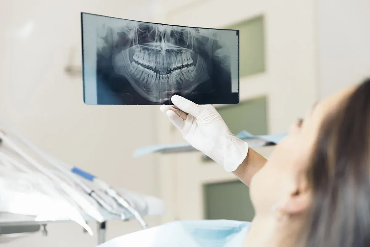Ngoài kiểm tra miệng, cổ và đầu, bác sĩ có thể yêu cầu chụp CT để giúp hình dung mức độ nhiễm trùng của bạn