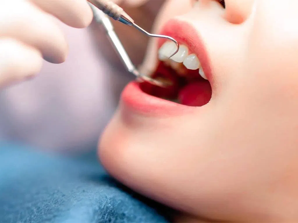 Nguyên nhân gây bệnh viêm tấy sàn miệng lan tỏa Ludwig là do nhiễm trùng nghiêm trọng ở sàn miệng, dưới lưỡi hoặc trên răng