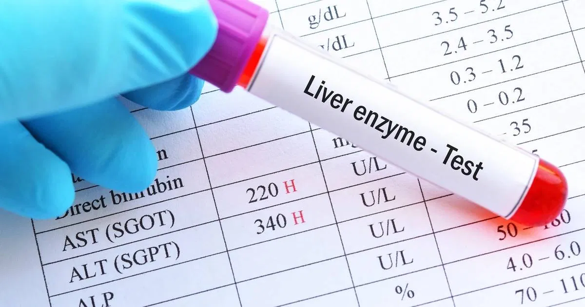 Nồng độ men gan cao